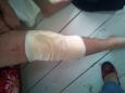 in verband